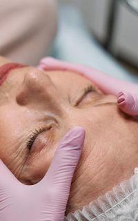 Woman undergoing a dermal filler procedure